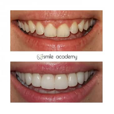 Slider image (4) Esthetic Smile Academy 